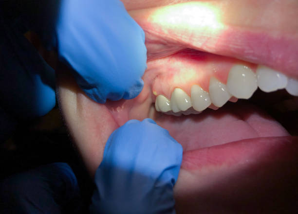 Best Walk-In Emergency Dental Services in Garrison, ND